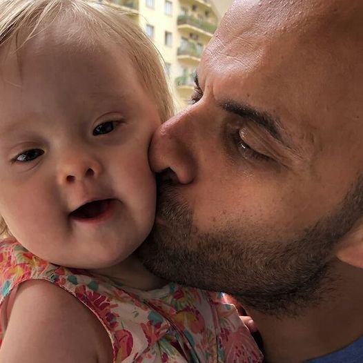 20 Families Had Previously Rejected An “Unusual” Girl Before A Single Man Adopted Her