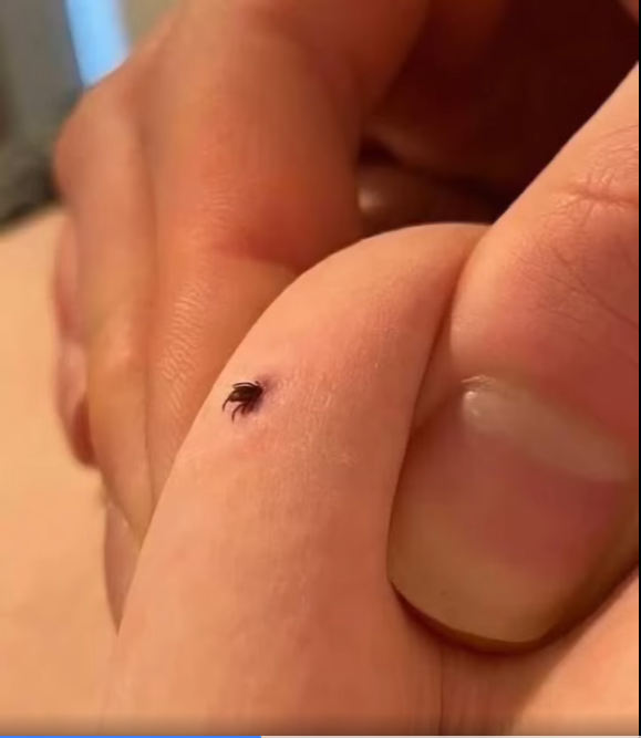 Actions To Take If You Discover a Tick in Your Home