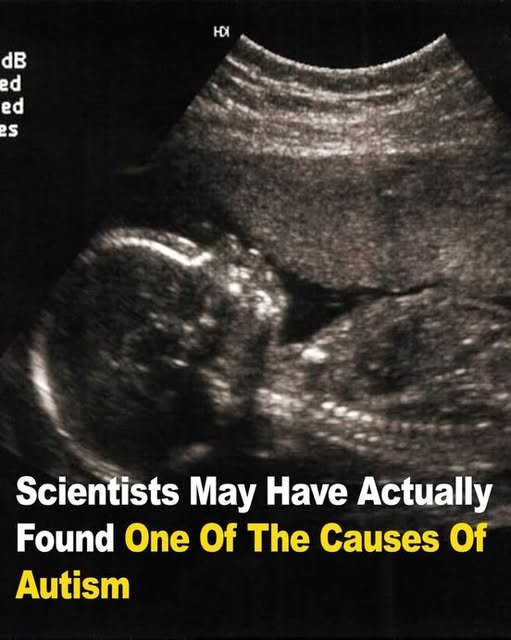Scientists May Have Actually Found One Of The Causes Of Autism
