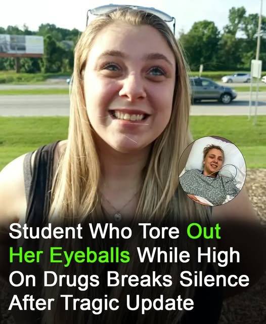 Student who tore out own eyeballs while high is fired from her job