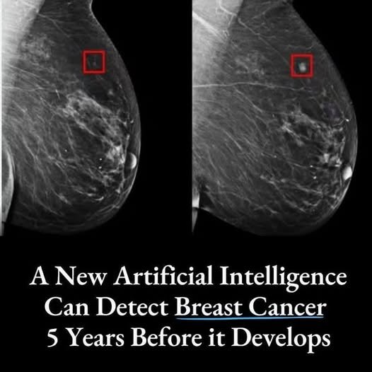 This is exactly the kind of thing we should be using Al for 👇