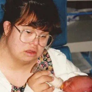 Down syndrome couple faces backlash after deciding to have children