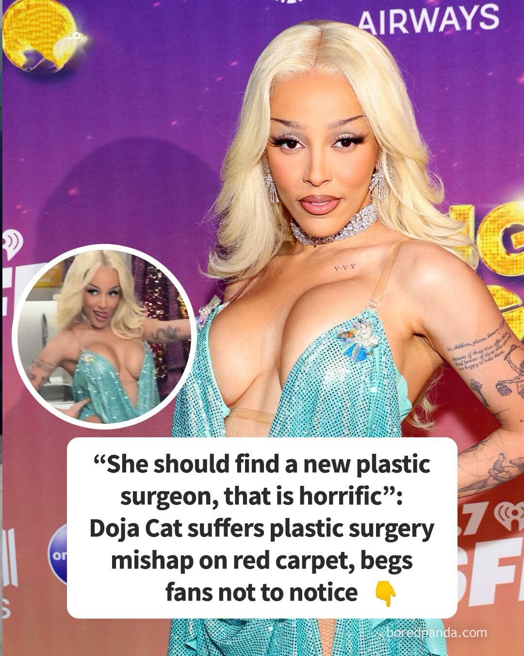 Ruthless Jokes Flood Internet After Doja Cat Shows Up On Red Carpet With Plastic Surgery Mishap