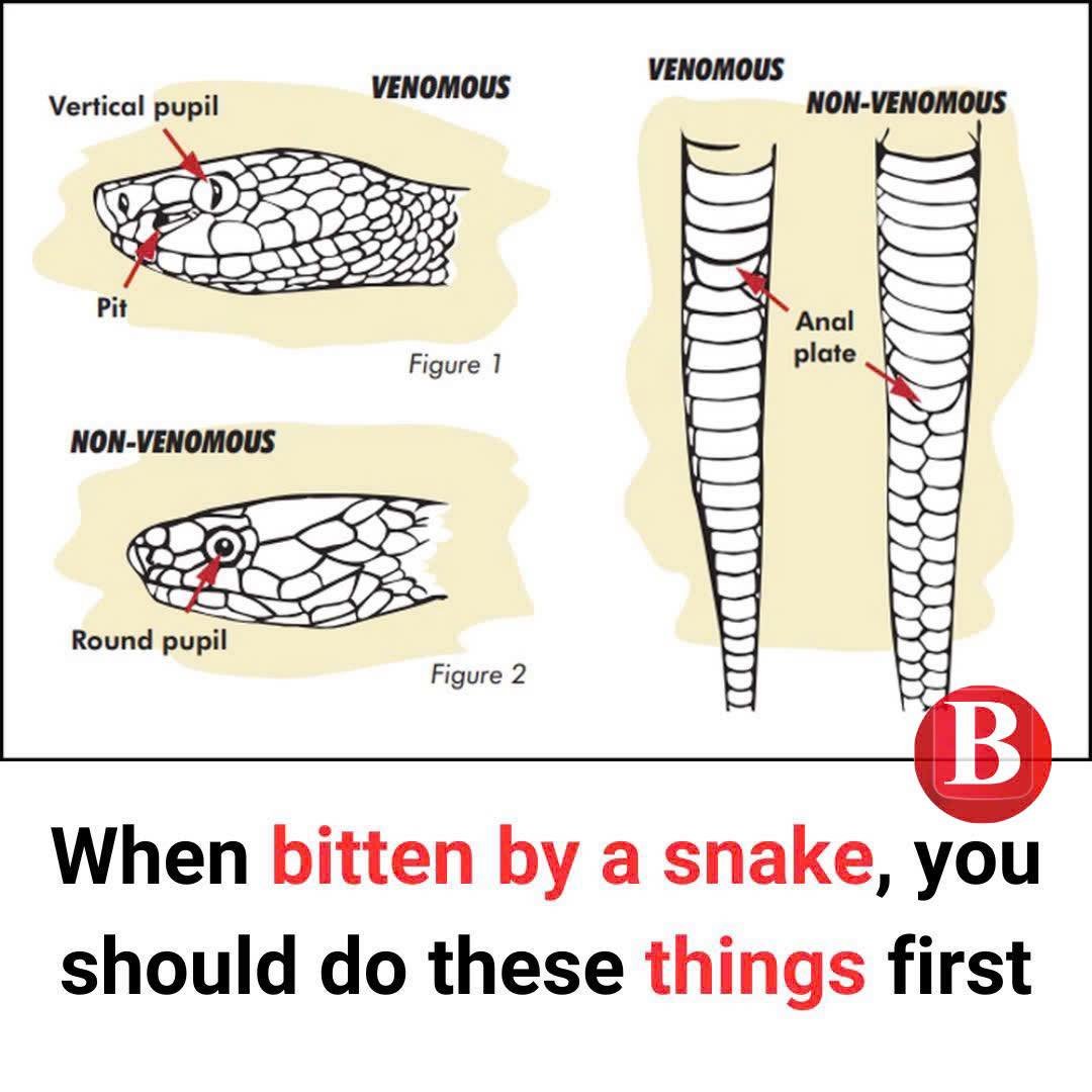 Snake bite signs and first aid you need to know