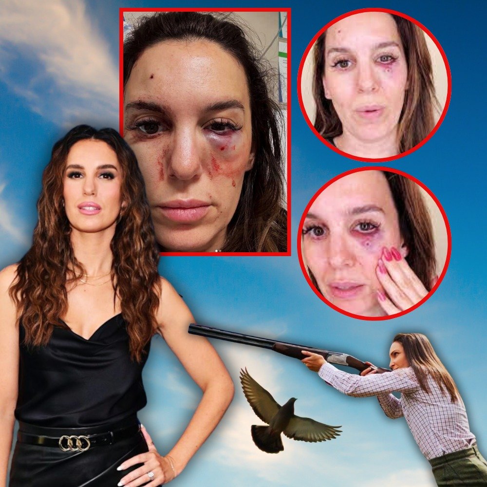 Christy Carlson Romano Details for the First Time the Moment She Was Shot in the Face: āOut of Bodyā Experience (Exclusive)
